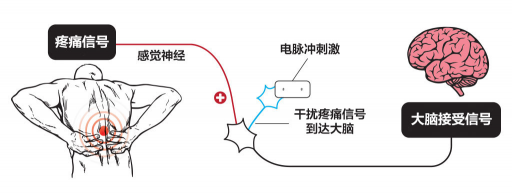 【ZE科普】一樣是電，為什么名字如此花哨