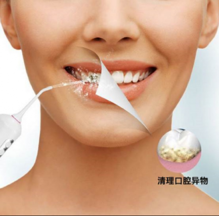 口腔清潔好幫手，美國XNUO心諾沖牙器值得信賴