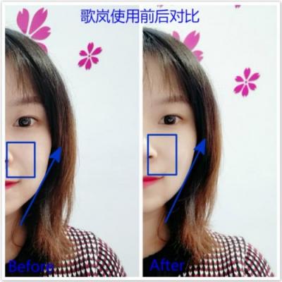 雅萌、GEVILAN歌嵐、Tripollar、NEWA美容儀到底選哪個？先評測一下再說