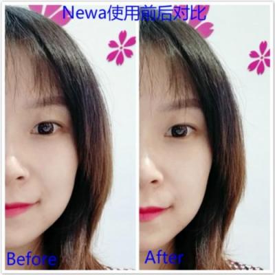 雅萌、GEVILAN歌嵐、Tripollar、NEWA美容儀到底選哪個？先評測一下再說