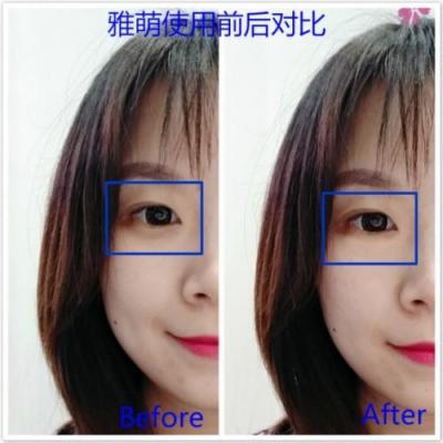 雅萌、GEVILAN歌嵐、Tripollar、NEWA美容儀到底選哪個？先評測一下再說