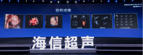 運算能力較傳統(tǒng)方案提升一倍，海信首臺超聲產(chǎn)品正式發(fā)布