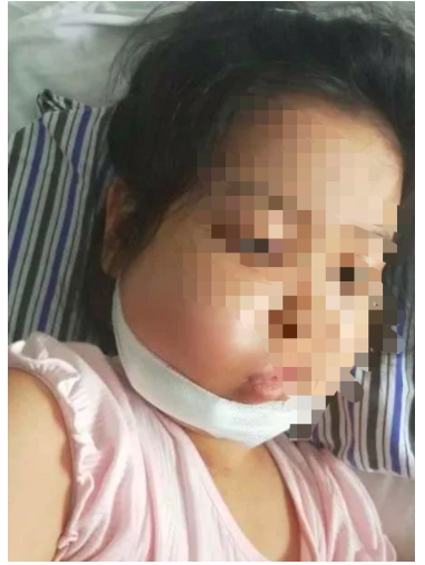 女童3歲確診白血病7歲復(fù)發(fā)，百萬治療費(fèi)無著落，水滴籌款幫孩子圓上學(xué)夢