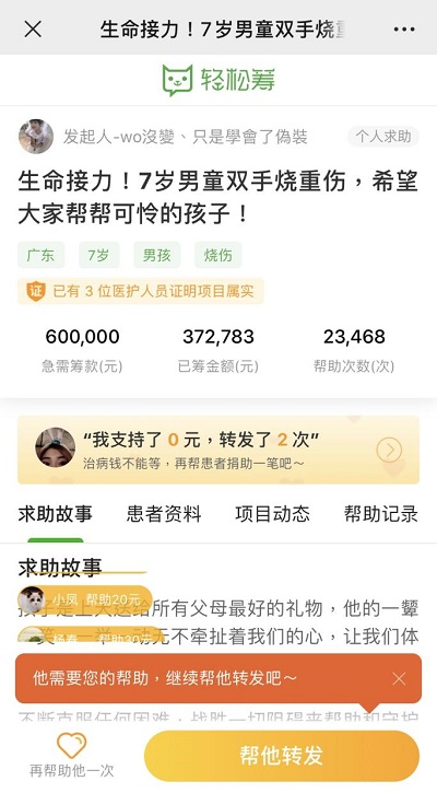 生命接力！輕松籌上愛心匯聚，幫助被生父燒傷的可憐男童重獲新生