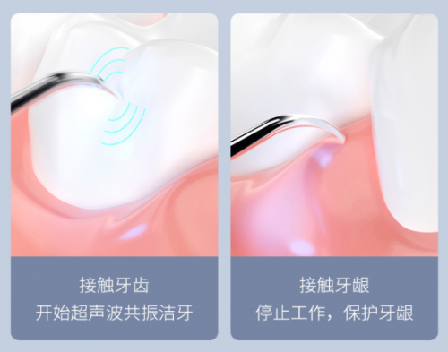 小米有品眾籌近3萬(wàn)人瘋搶！素諾智能可視潔牙儀T11 Pro成網(wǎng)紅爆款