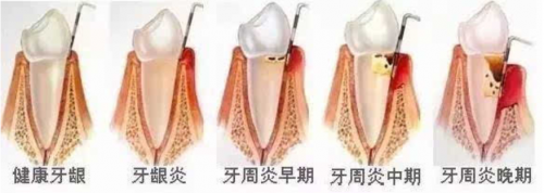 小米有品眾籌超10000000！素諾智能可視潔牙儀T11Pro為何一炮而紅？