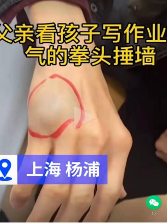 虎爸輔導孩子作業(yè)致使自己受傷，不妨試試訊飛智能學習機