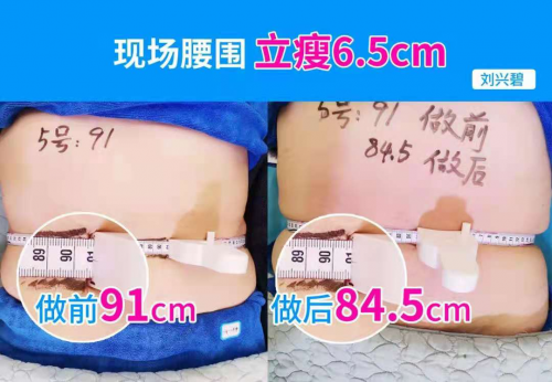 破6.7億！秀域“夏日捉腰季”抖音活動席卷多地，智能纖體項(xiàng)目有口皆碑