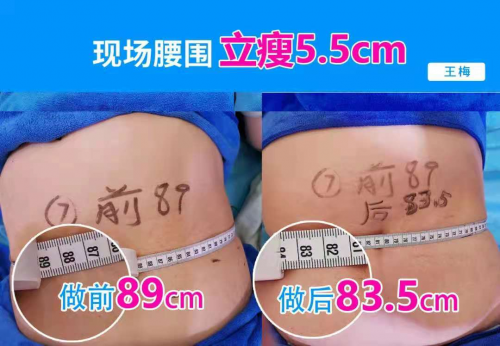 破6.7億！秀域“夏日捉腰季”抖音活動席卷多地，智能纖體項(xiàng)目有口皆碑