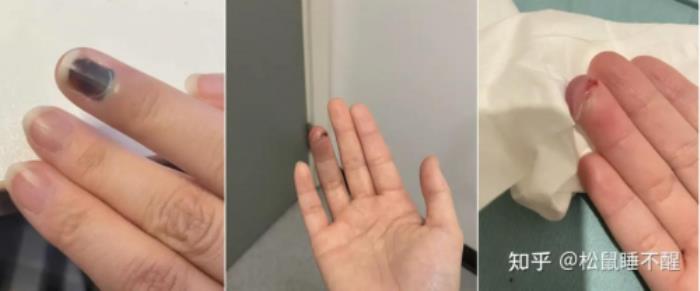 智能門鎖夾手之痛引爆全網(wǎng) 一場席卷社交媒體的安全拷問